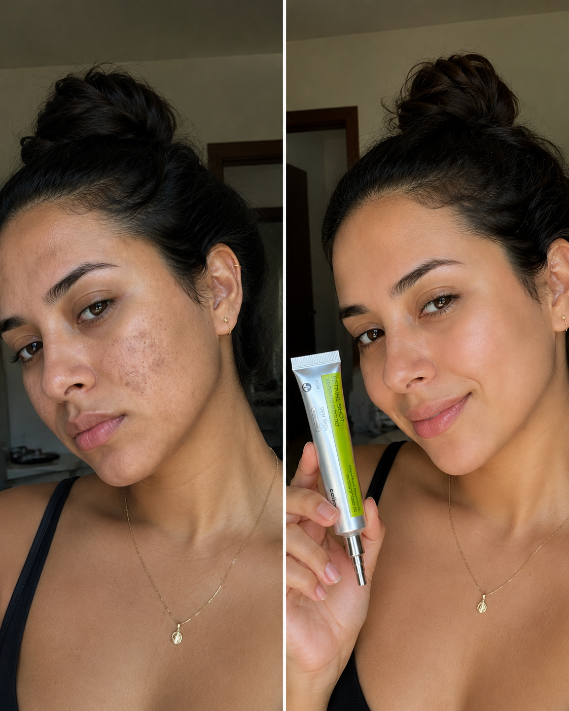 Comparação antes e depois do uso do Celimax The Vita A Retinal Shot Tightening Booster